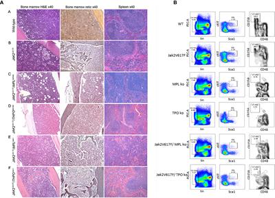 The Thrombopoietin Receptor, MPL, Is a Therapeutic Target of Opportunity in the MPN